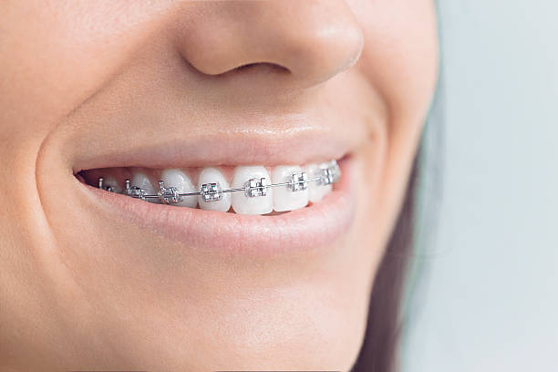 Best Traditional Braces  in Hillview, KY